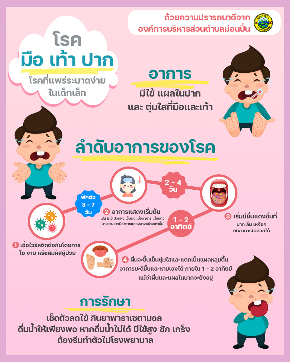 ภาพประกอบ การสังเกตุอาการโรค มือ เท้า ปาก โรคที่แพร่ระบาดง่ายในเด็กเล็ก